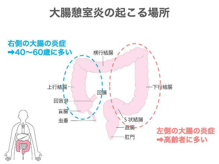 画像に alt 属性が指定されていません。ファイル名: d31e3bc3ff21a90e24210fbbff06fa78.png